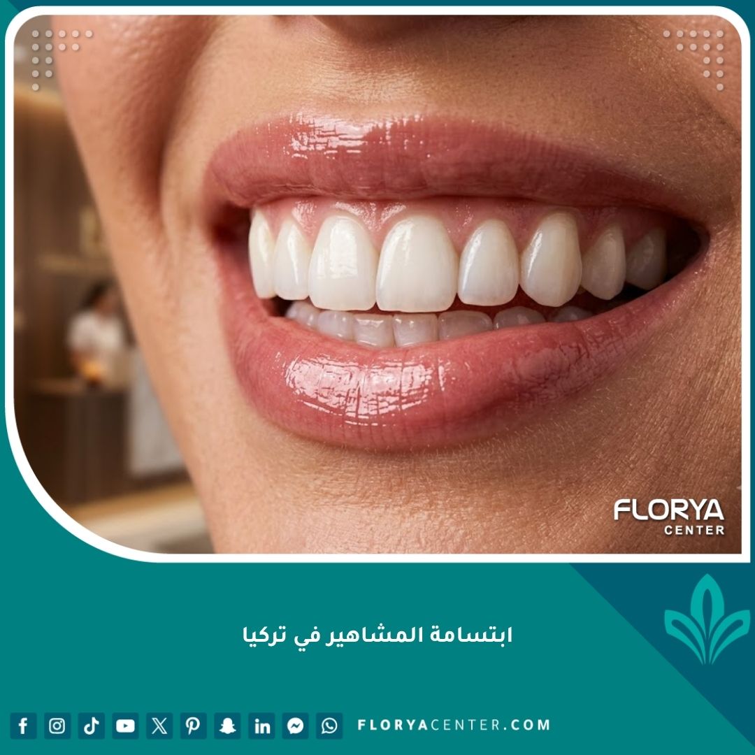 صورة مقربة تبرز جمال ابتسامة المشاهير في تركيا بأسنان ناصعة البياض وتناسق مثالي يعكس الفخامة.