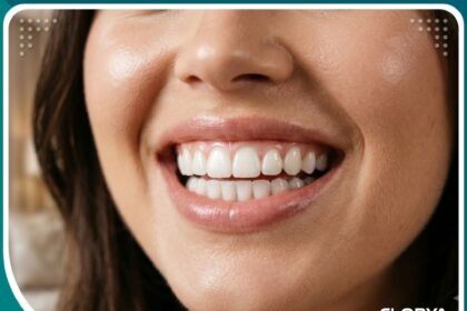 صورة مقربة لابتسامة مثالية وجذابة توضح النتائج الرائعة بعد علاج الابتسامة اللثوية في تركيا.
