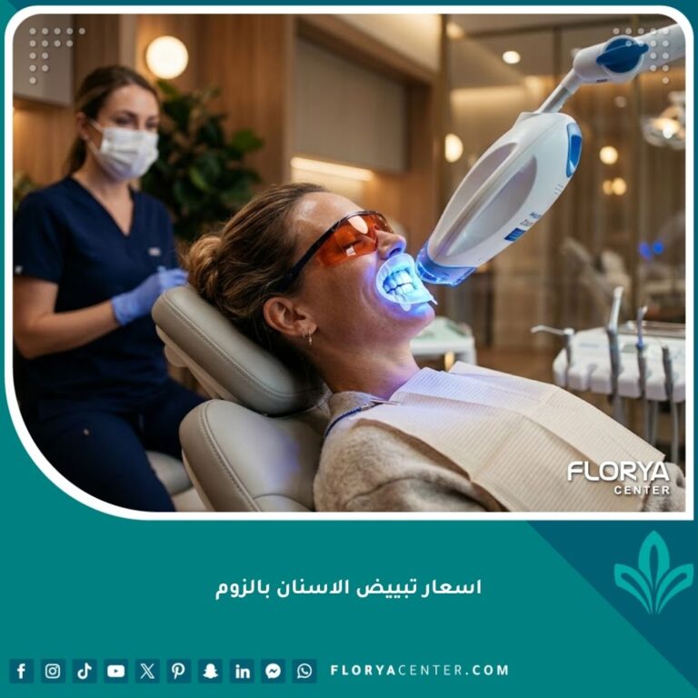 اسعار تبييض الاسنان بالزوم في عيادات الأسنان المتخصصة ونتائج الابتسامة المشرقة
