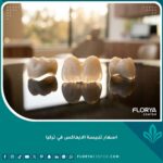 أسعار تلبيسة الايماكس في تركيا للحصول على ابتسامة هوليوود طبيعية
