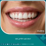 صورة سينمائية تظهر ابتسامة مشرقة ولثة وردية صحية بعد عملية توريد اللثة بالليزر في تركيا.