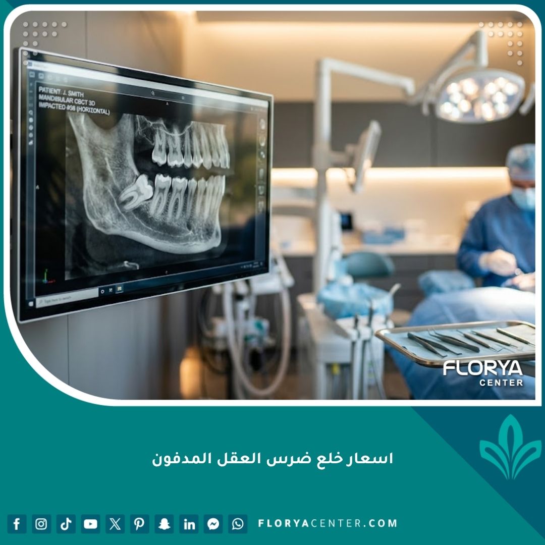تكلفة واسعار خلع ضرس العقل المدفون في مركز أسنان متطور
