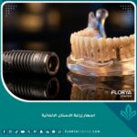 اسعار زراعة الاسنان الالمانية ومكونات زرعة التيتانيوم عالية الجودة
