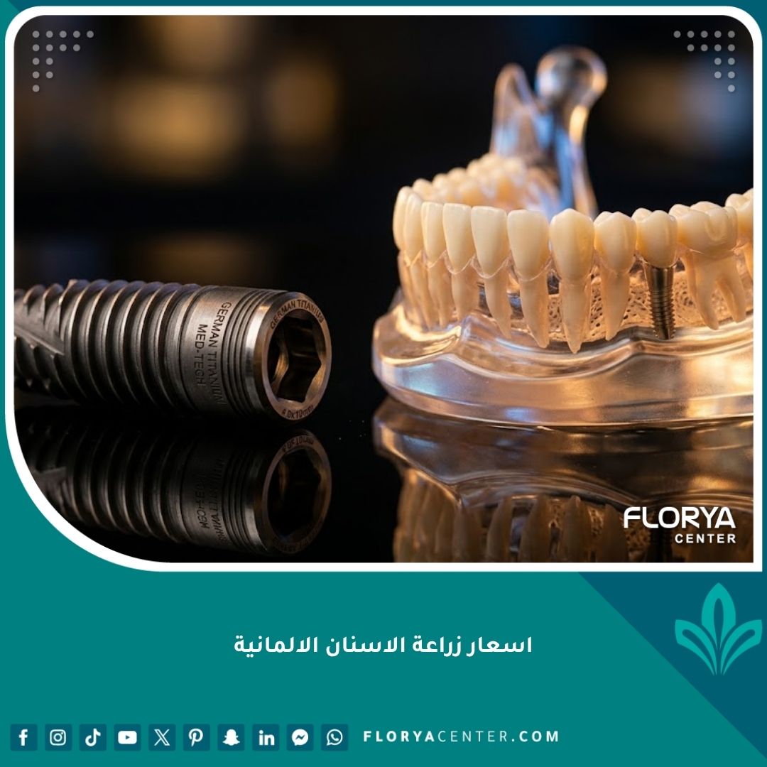 اسعار زراعة الاسنان الالمانية ومكونات زرعة التيتانيوم عالية الجودة