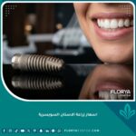 أسعار زراعة الأسنان السويسرية في تركيا والفرق بين أنواع الزرعات الفاخرة