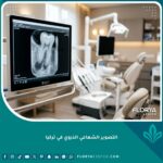 شاشة رقمية حديثة تعرض نتيجة التصوير الشعاعي الذروي في تركيا داخل عيادة أسنان متطورة.