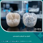 صورة مقربة عالية الدقة توضح الفرق بين الزيركون والبورسلين في تجميل وتلبيس الأسنان.