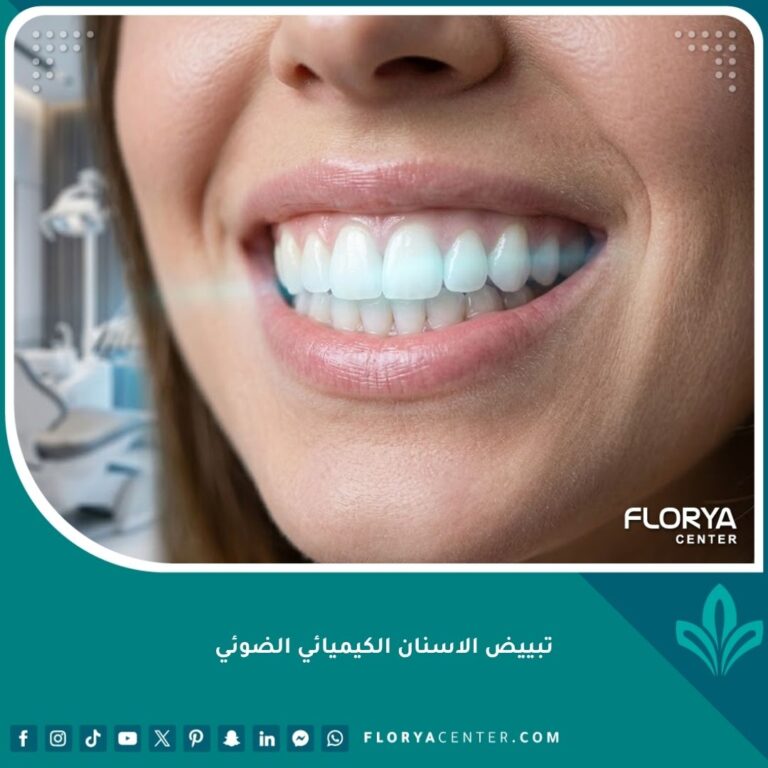 صورة قريبة لابتسامة ناصعة البياض تبرز جمال تبييض الاسنان الكيميائي الضوئي باستخدام الليزر الأزرق.