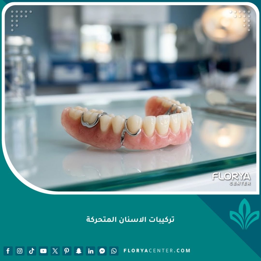 صورة عالية الدقة توضح شكل تركيبات الاسنان المتحركة وتصميمها الطبيعي.