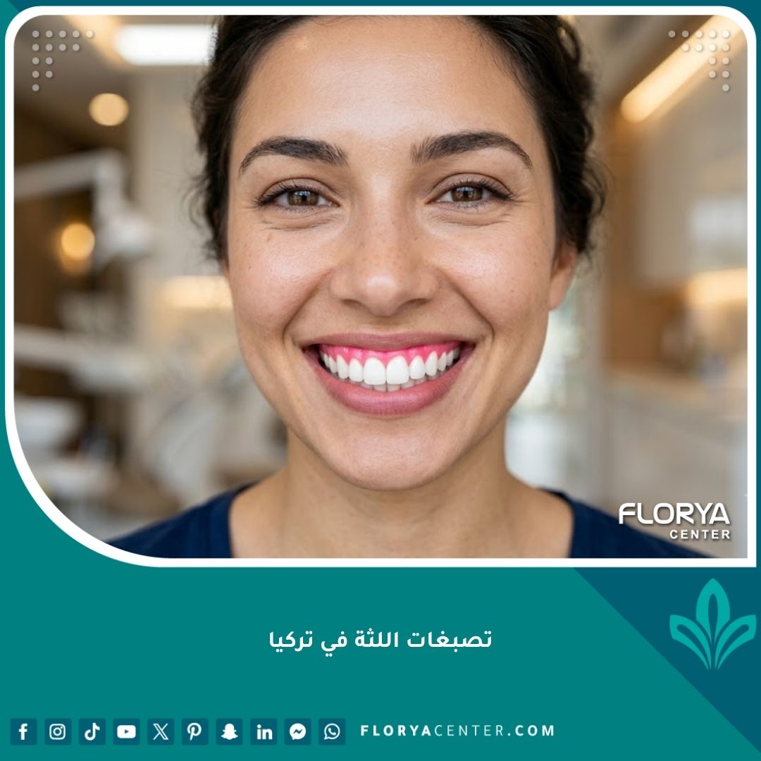 ابتسامة صحية ولثة وردية بعد علاج تصبغات اللثة في تركيا