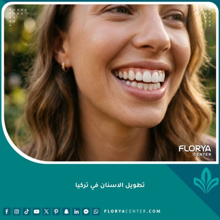 صورة مقربة لابتسامة مثالية تبرز نتائج عملية تطويل الأسنان في تركيا وعلاج الأسنان القصيرة.