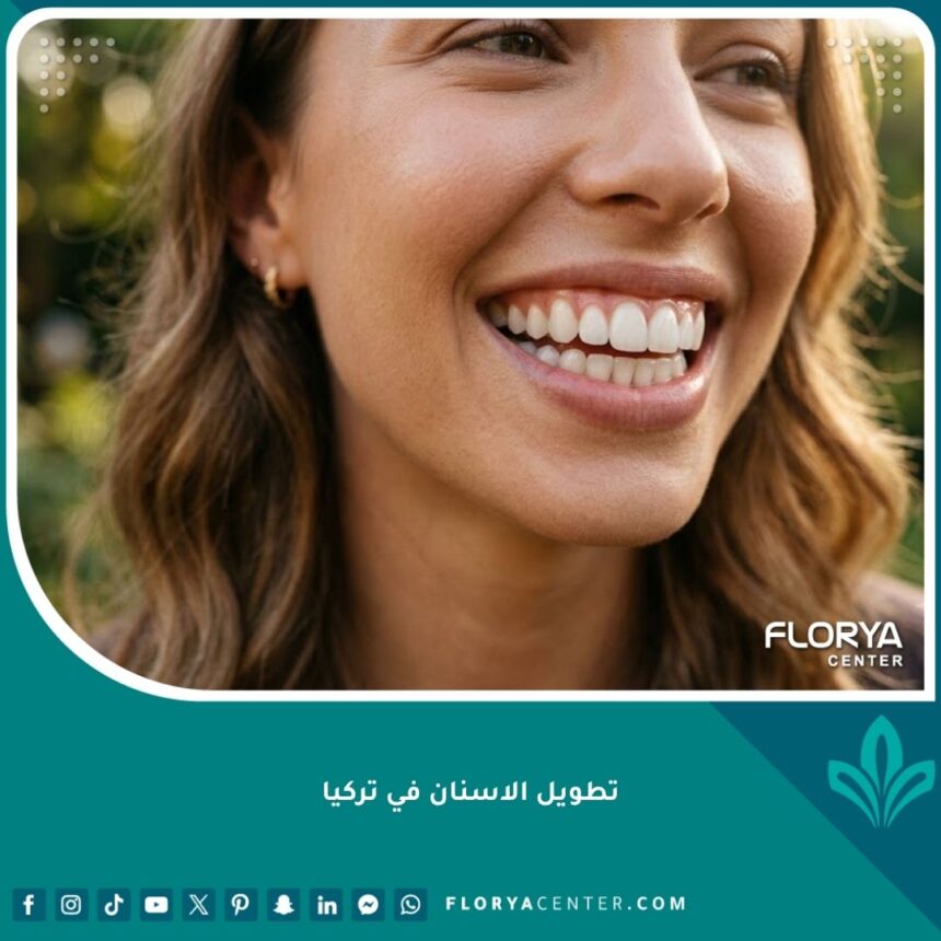 تطويل الاسنان في تركيا 1 صورة مقربة لابتسامة مثالية تبرز نتائج عملية تطويل الأسنان في تركيا وعلاج الأسنان القصيرة.