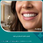 صورة مقربة لابتسامة مثالية وناصعة البياض توضح نتائج عملية تعديل شكل الأسنان في تركيا.