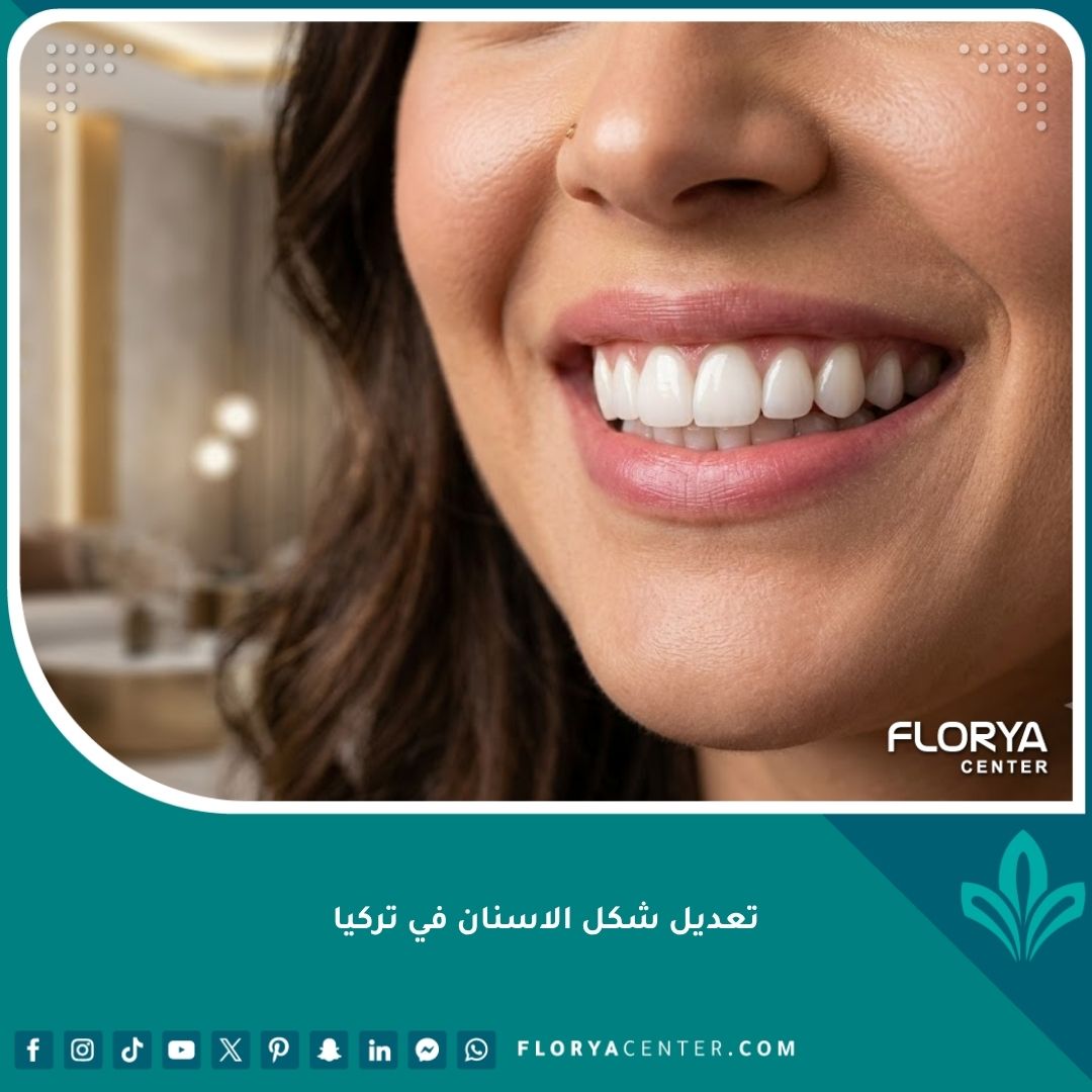 صورة مقربة لابتسامة مثالية وناصعة البياض توضح نتائج عملية تعديل شكل الأسنان في تركيا.
