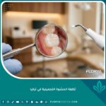 تكلفة الحشوة التجميلية في تركيا وعلاج الأسنان بالعيادات الحديثة في إسطنبول