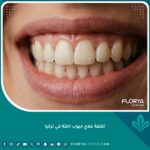 تكلفة علاج جيوب اللثة في تركيا للحصول على ابتسامة صحية وتجنب تراجع اللثة.
