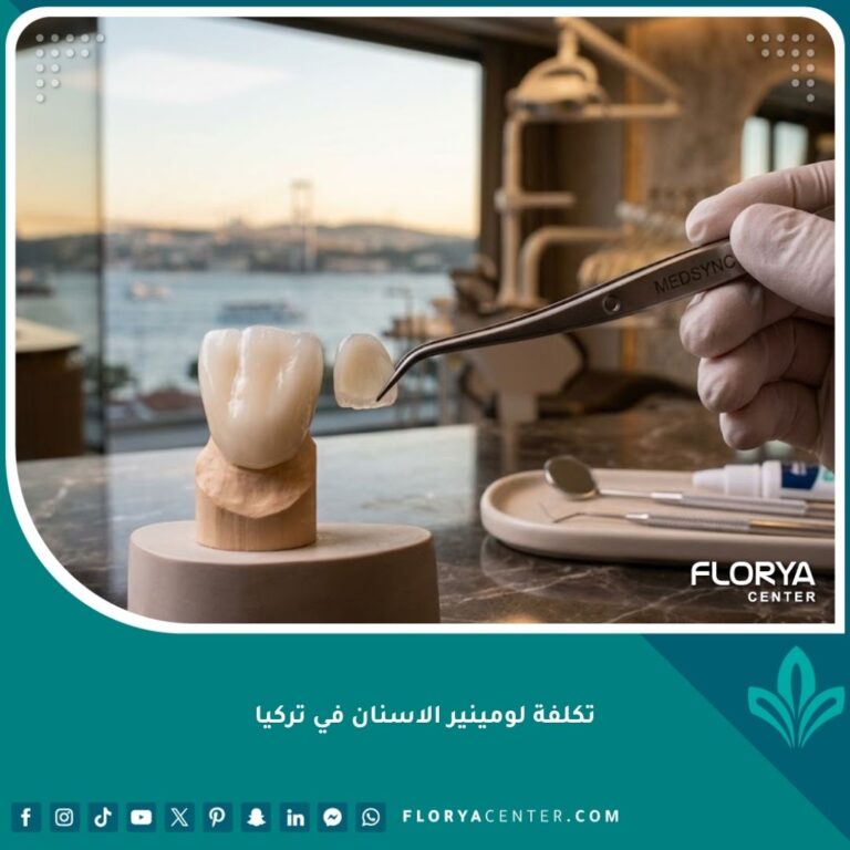 تكلفة لومينير الأسنان في تركيا وقشور الأسنان التجميلية الفاخرة بدون برد