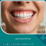 ابتسامة جذابة تظهر لثة وردية صحية وناصعة بعد الخضوع لعملية توريد اللثة جراحيا في تركيا.