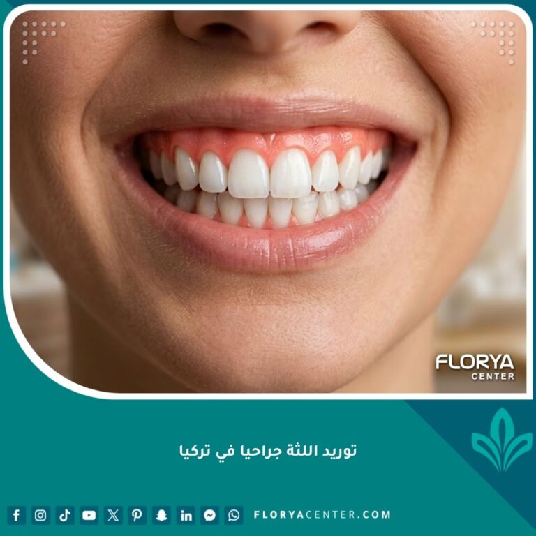ابتسامة جذابة تظهر لثة وردية صحية وناصعة بعد الخضوع لعملية توريد اللثة جراحيا في تركيا.