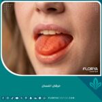 صورة تعبيرية دقيقة توضح الشعور بألم وحرارة متلازمة حرقان اللسان والفم.