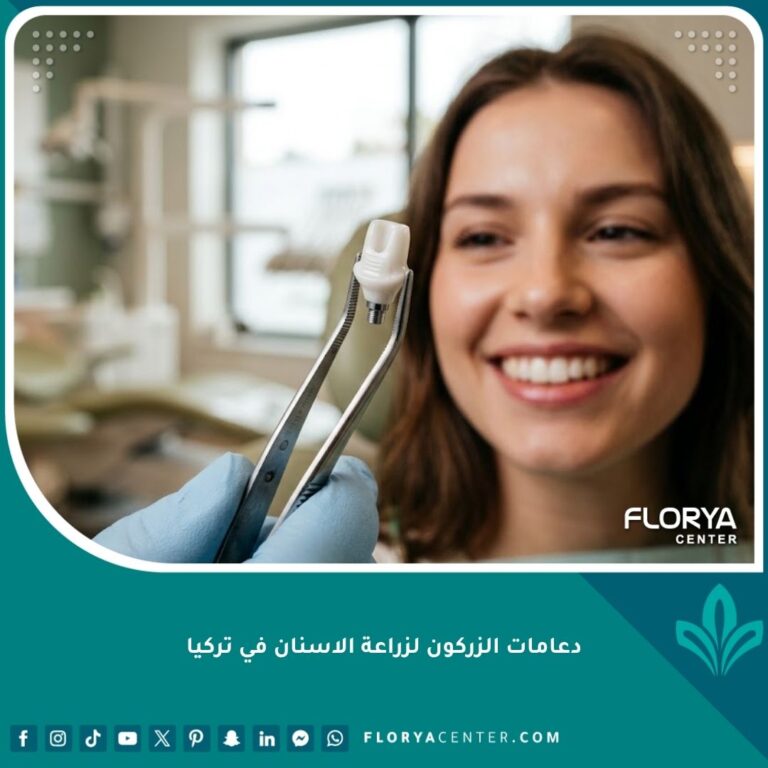 صورة مقربة لدعامة الزركون البيضاء المستخدمة في زراعة الأسنان في تركيا، تظهر النقاء والجماليات الخالية من المعدن لابتسامة طبيعية.