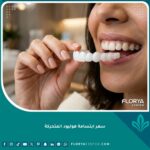 صورة مقربة تظهر شكل ابتسامة هوليود المتحركة أو سناب أون سمايل قبل تركيبها على الأسنان لتجميل الابتسامة.