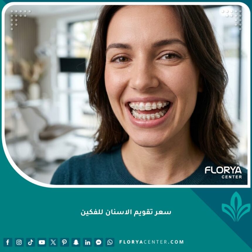 صورة مقربة لابتسامة جذابة توضح تركيب تقويم الأسنان للفكين العلوي والسفلي، تعكس الجودة والاحترافية في العلاج.