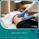 صورة مقربة لشد الترهلات بالخيوط التجميلية في منطقة البطن للحصول على شد فوري بدون جراحة في عيادة طبية.