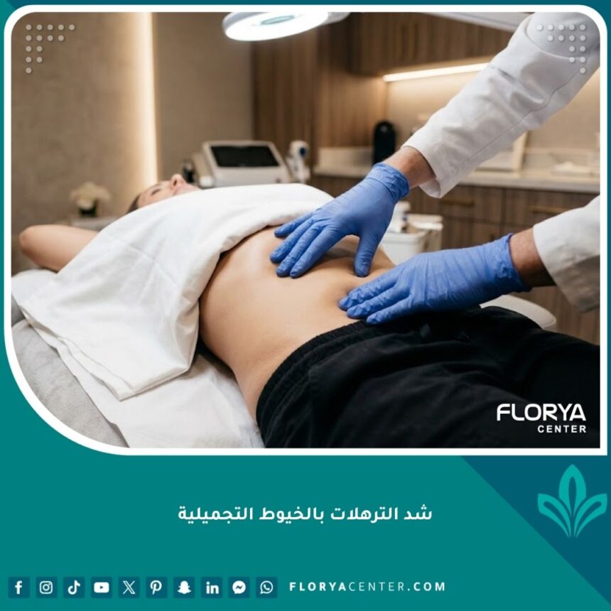 صورة مقربة لشد الترهلات بالخيوط التجميلية في منطقة البطن للحصول على شد فوري بدون جراحة في عيادة طبية.