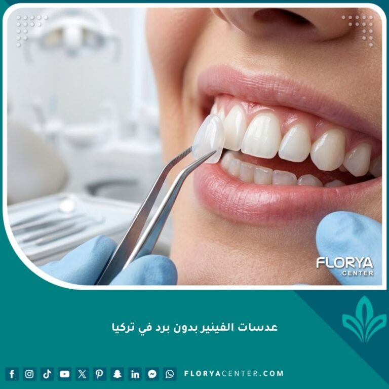 تركيب عدسات الفينير بدون برد في تركيا للحصول على ابتسامة هوليوود بيضاء ومشرقة بدون نحت الأسنان.
