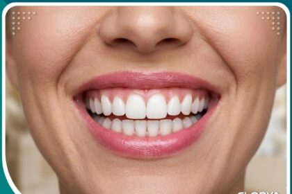 ابتسامة صحية وناصعة البياض بعد علاج تشققات الأسنان في تركيا للحصول على مينا خالية من العيوب.