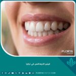 صورة مقربة لابتسامة جذابة تبرز جمال وشفافية فينير الايماكس الذي يطابق الأسنان الطبيعية تماماً.