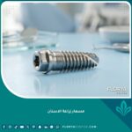 صورة مقربة عالية الدقة توضح شكل مسمار زراعة الاسنان التيتانيوم عالي الجودة المستخدم في تعويض الأسنان المفقودة.