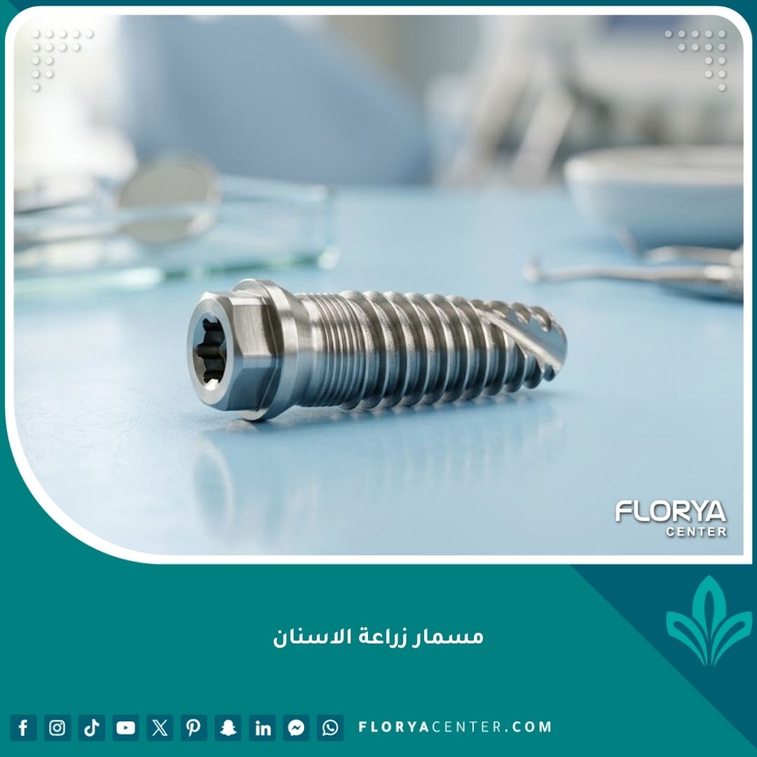 صورة مقربة عالية الدقة توضح شكل مسمار زراعة الاسنان التيتانيوم عالي الجودة المستخدم في تعويض الأسنان المفقودة.