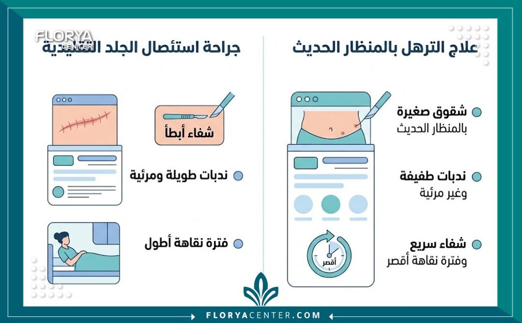 إنفوجرافيك يقارن بين الجراحة التقليدية ومميزات علاج الترهل الشديد بالمنظار المتقدم.