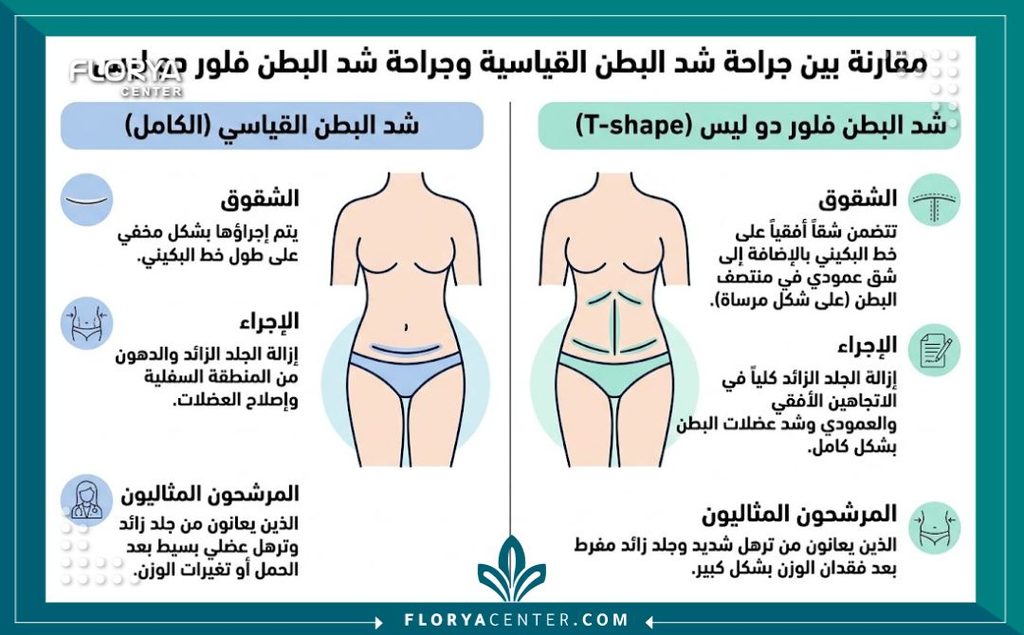 إنفوجرافيك يقارن بين عملية شد البطن التقليدية وعملية شد البطن المقلوب Fleur-de-Lis للترهلات الشديدة مع أفضل جراح لعملية شد البطن.