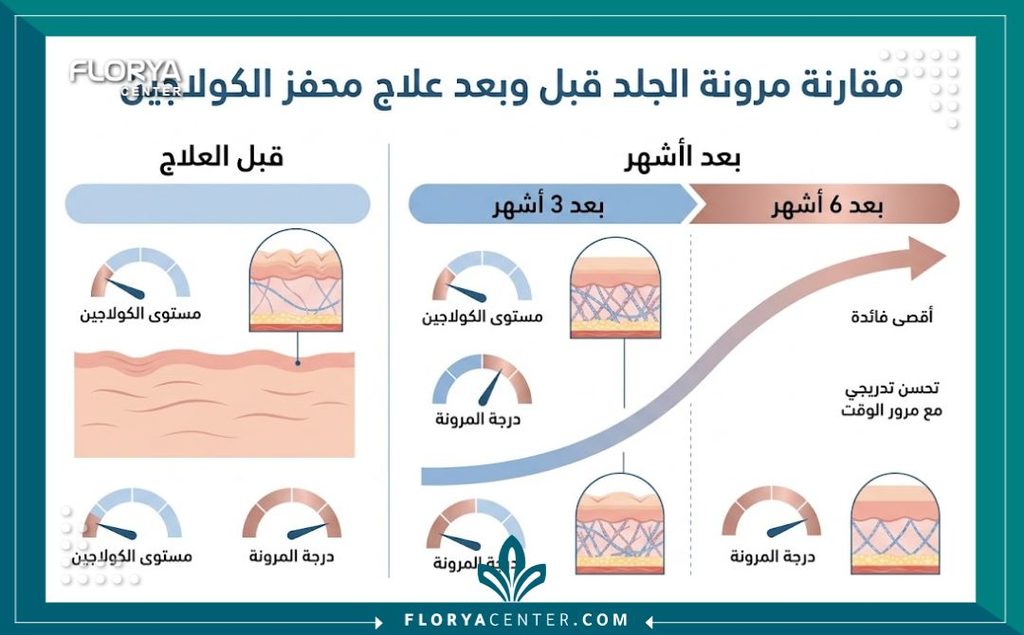 إنفوجرافيك يوضح الجدول الزمني لظهور نتائج ابر تحفيز الكولاجين للترهلات والتحسن التدريجي في مرونة الجلد.