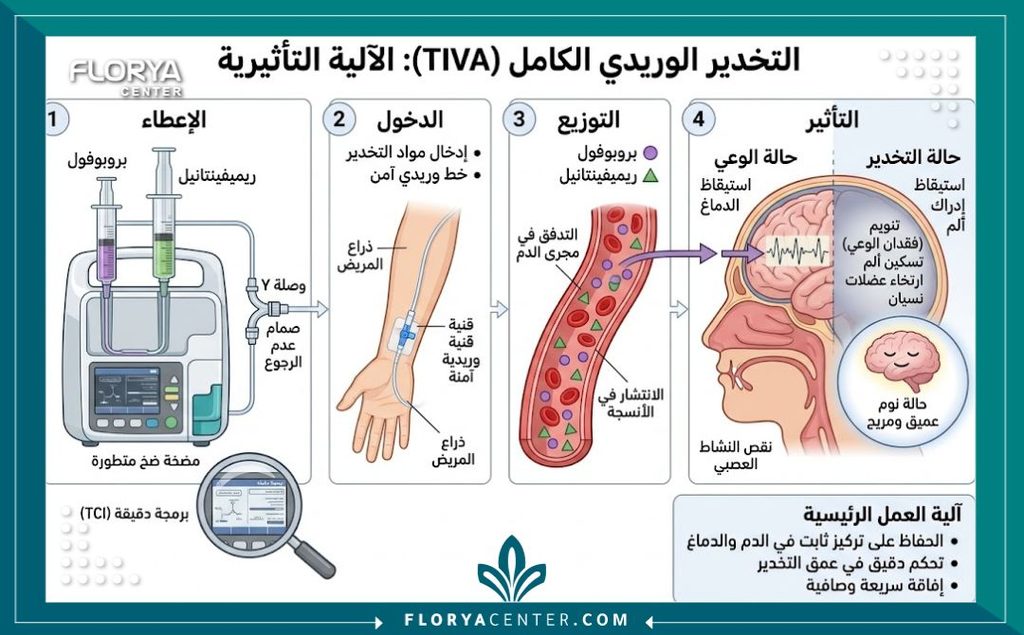رسم توضيحي طبي يشرح آلية عمل التخدير الوريدي العميق لعمليات شد الجسم عبر المضخة الوريدية بأمان.