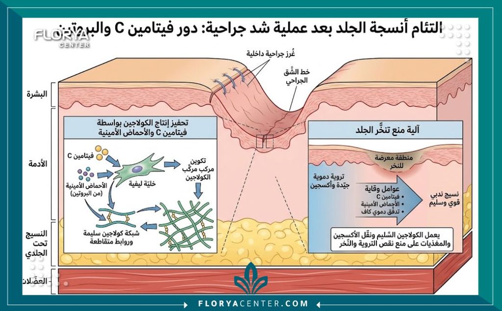 رسم توضيحي طبي لطبقات الجلد يوضح دور الكولاجين والبروتين في التئام الجروح ومنع نخر الجلد بعد عمليات الشد.