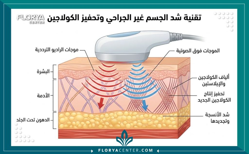 رسم توضيحي طبي يشرح آلية عمل أجهزة شد الجسم بدون جراحة على طبقات الجلد وتحفيز الكولاجين.