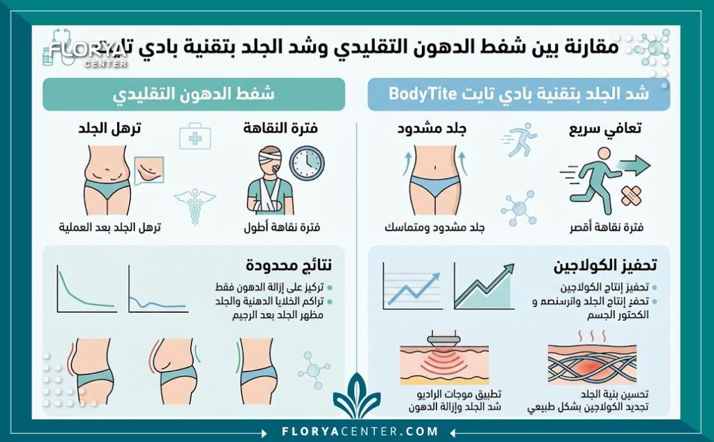 تقنية البودي تايت 3 إنفوجرافيك يقارن شفط الدهون التقليدي مع تقنية البودي تايت التي تمنع ترهل الجلد بعد العملية.