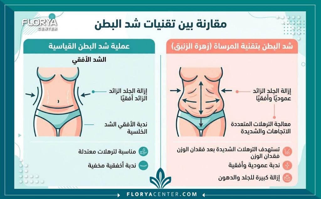 إنفوجرافيك يقارن بين الشد التقليدي والشد المقلوب لإزالة الترهل العرضي والطولي معاً.