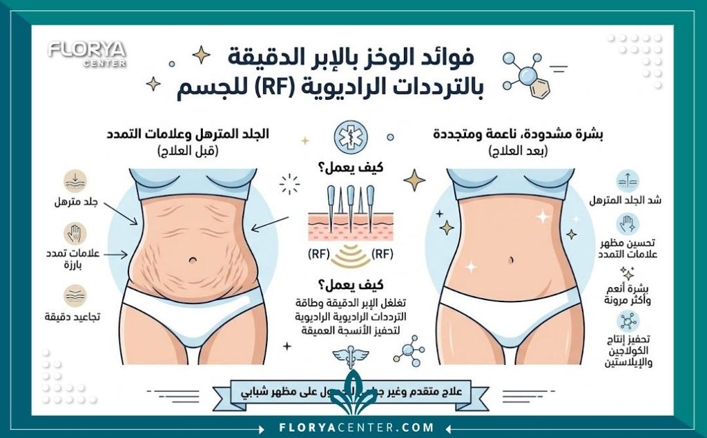 إنفوجرافيك يوضح فوائد ونتائج قبل وبعد استخدام الميكرونيدلينغ والراديو فريكونسي مثل جهاز المورفيوس 8 للجسم.