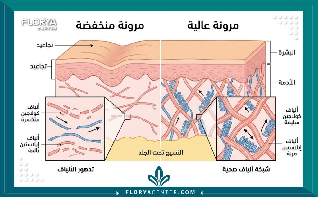 رسم توضيحي طبي لطبقات الجلد يوضح ألياف الكولاجين والإيلاستين المسؤولة عن انكماش الجلد بعد شفط الدهون.