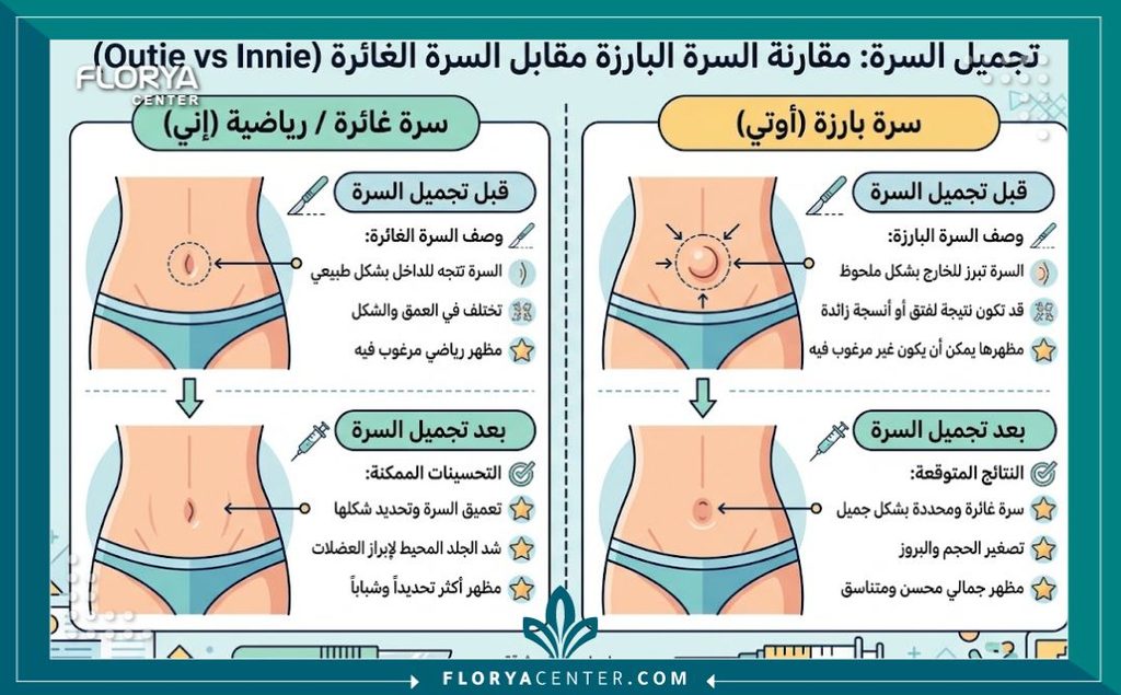 إنفوجرافيك يقارن بين أشكال السرة البارزة والغائرة قبل وبعد جراحة تجميل السرة للحصول على مظهر رياضي.