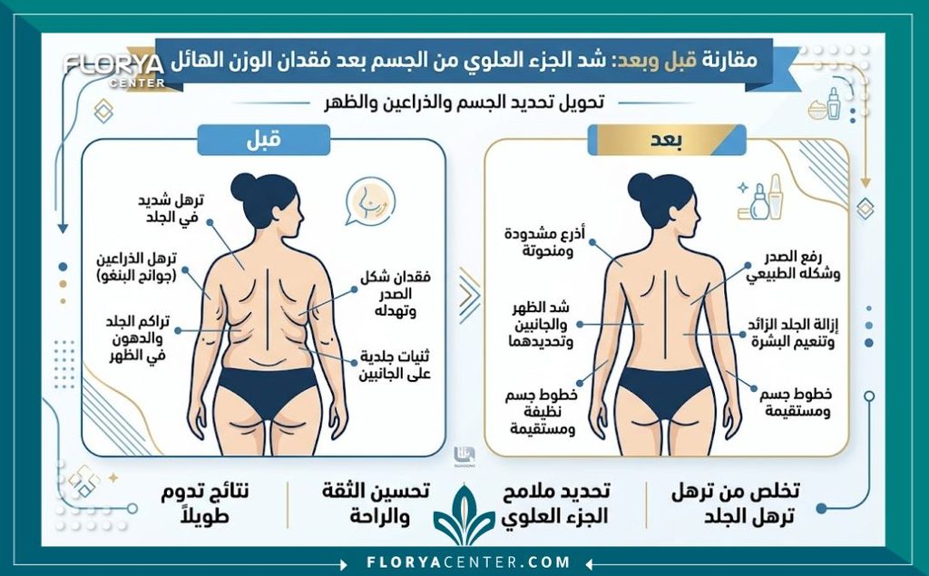 جراحة شد الأطراف العلوية (Upper Body Lift) 3 إنفوجرافيك يوضح مقارنة قبل وبعد جراحة شد الجزء العلوي من الجسم وإزالة الترهلات الشديدة بعد فقدان الوزن.