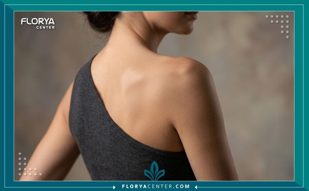 جراحة شد الأطراف العلوية (Upper Body Lift) 5 لقطة قريبة تبرز الجمال وتناسق الذراعين والكتفين بعد التخلص من الترهلات عبر عملية شد النصف العلوي من الجسم.