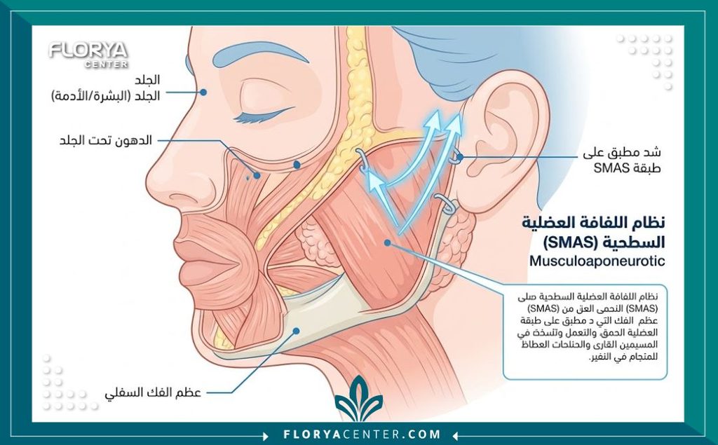 رسم توضيحي طبي يوضح طبقات الوجه واستهداف الأنسجة اللفافية السطحية SFS للشد الميكانيكي العميق.