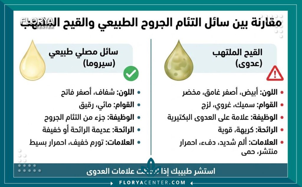 إنفوجرافيك يقارن بين خروج سائل اصفر من جرح شد البطن الشفاف والصديد المسبب للإنتان للتمييز بينهما.