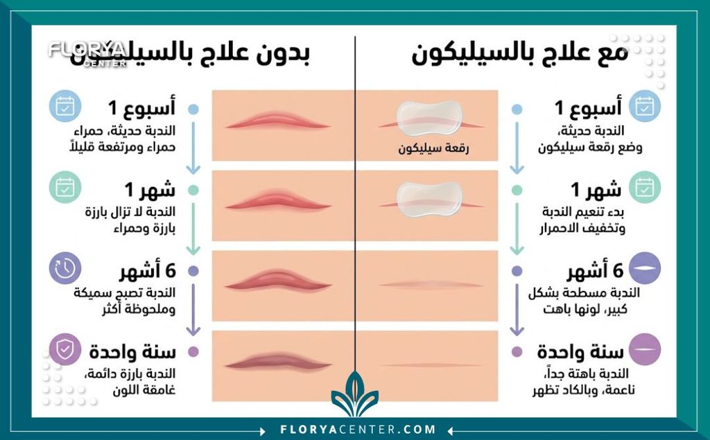 إنفوجرافيك يقارن نتائج التئام الجلد باستخدام كريم سيليكون جروح العمليات وبدونه.
